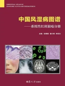 中国风湿病图谱 系统性红斑狼疮分册