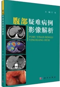 腹部疑难病例影像解析