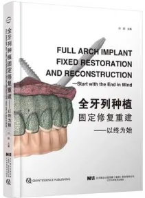 全牙列种植固定修复重建——以终为始