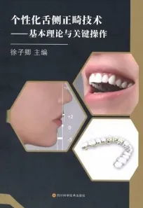 个性化舌侧正畸技术 基本理论与关键操作