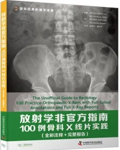 放射学非官方指南 100例骨科X线片实践