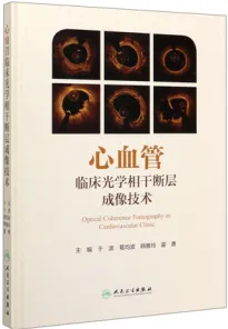 心血管临床光学相干断层成像技术