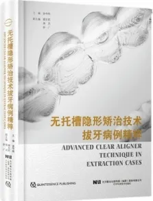 无托槽隐形矫治技术拔牙病例精粹