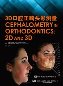 3D口腔正畸头影测量