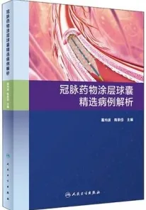 冠脉药物涂层球囊精选病例解析