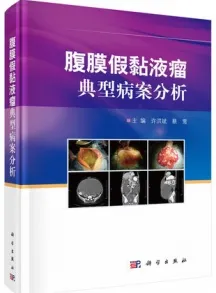 腹膜假黏液瘤典型病案分析