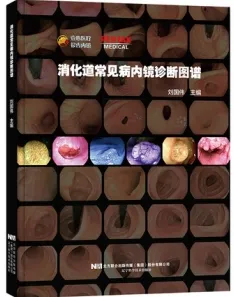 消化道常见病内镜诊断图谱