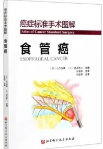 癌症标准手术图解 食管癌