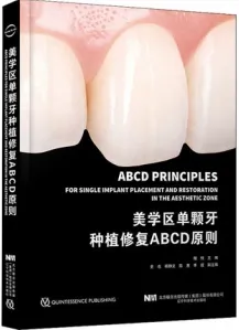 美学区单颗牙种植修复ABCD原则