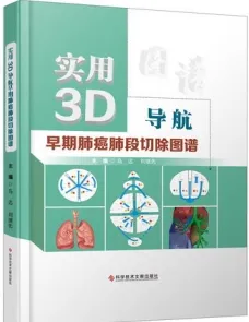 实用3D导航早期肺癌肺段切除图谱