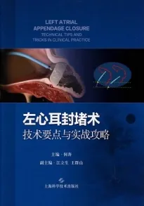 左心耳封堵术 技术要点与实战攻略