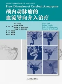 颅内动脉瘤的血流导向介入治疗