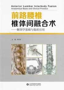 前路腰椎椎体间融合术