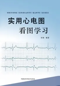实用心电图看图学习