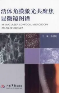 活体角膜激光扫描共聚焦显微镜图谱