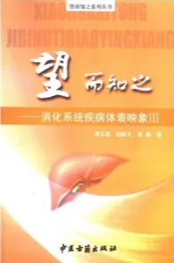 望而知之 消化系统疾病体表映象 III