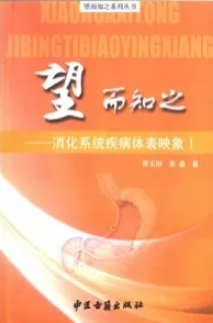 望而知之 消化系统疾病体表映象 I