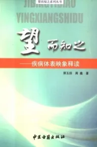 望而知之 疾病体表映象释读