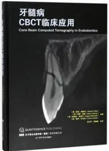 牙髓病CBCT临床应用