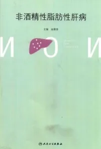 非酒精性脂肪性肝病