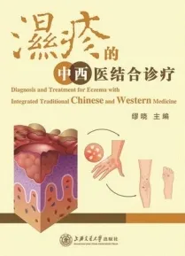 湿疹的中西医结合诊疗