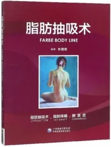脂肪抽吸术