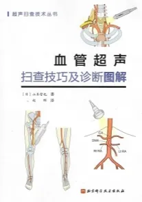 血管超声扫查技巧及诊断图解