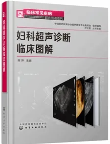 妇科超声诊断临床图解