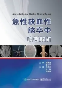 急性缺血性脑卒中病例解析