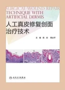 人工真皮修复创面治疗技术