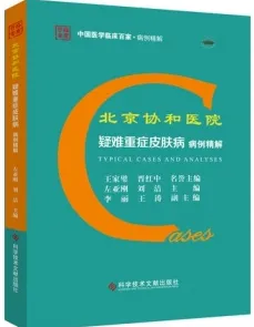 北京协和医院疑难重症皮肤病病例精解