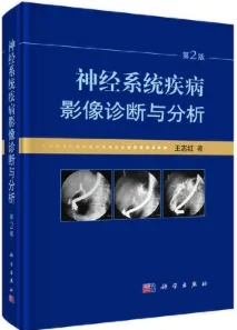 神经系统疾病影像诊断与分析 第2版