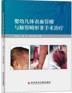 婴幼儿体表血管瘤与脉管畸形非手术治疗