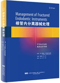 根管内分离器械处理