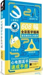 心电图高手速成手册 第4版