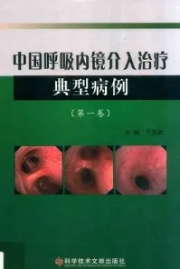 中国呼吸内镜介入治疗典型病例 第1卷