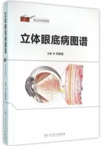 立体眼底病图谱