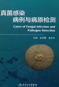 真菌感染病例与病原检测
