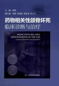 药物相关性颌骨坏死 临床诊断与治疗