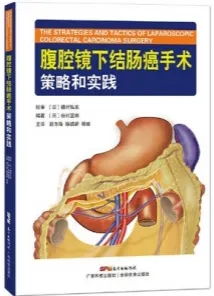 腹腔镜下结肠癌手术策略和实践