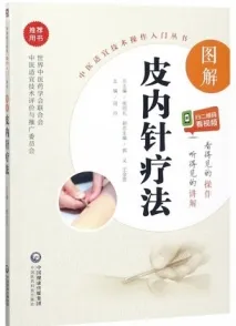 图解皮内针疗法