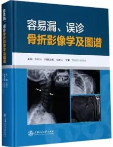 容易漏、误诊骨折影像学及图谱