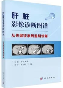 肝脏影像诊断图谱 从关键征象到鉴别诊断