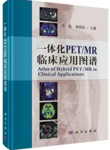 一体化PET_MR临床应用图谱