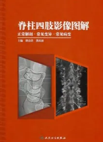 脊柱四肢影像图解 正常解剖·常见变异·常见病变