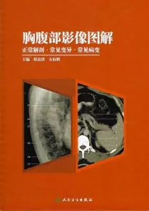 胸腹部影像图解 正常解剖·常见变异·常见病变