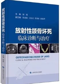 放射性颌骨坏死 临床诊断与治疗