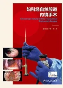 妇科经自然腔道内镜手术