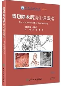 胃切除术后消化道重建