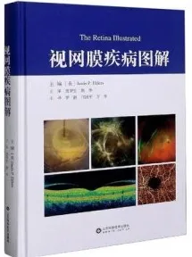 视网膜疾病图解